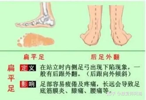 早日康复！龚莉前十字交叉韧带全部断裂待膝盖消肿后进行手术